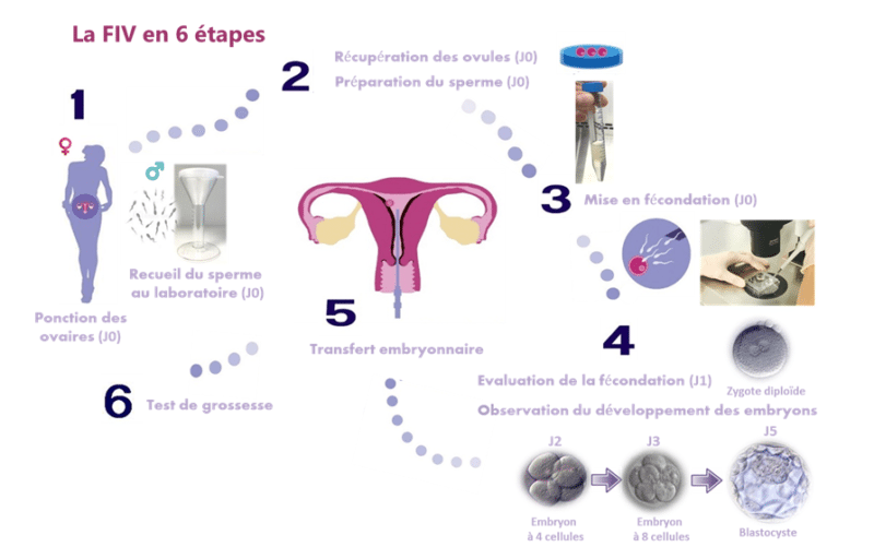 La technique FIV Centre AMP St Roch PMA Montpellier